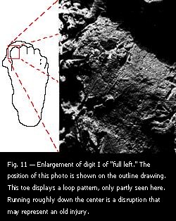 Fig. 11 — Enlargement of digit I of "full left."