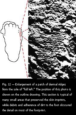 Fig. 12 — Enlargement of a patch of dermal ridges from the sole of "full left."